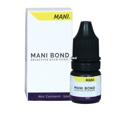Keo dán nha khoa Mani Bond 