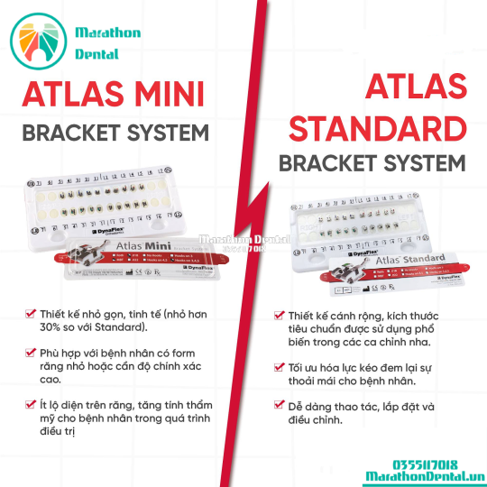 Mắc cài kim loại Atlas Mini